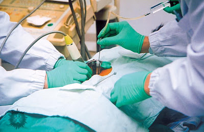 乳腺穿刺活检并非“金标准”
