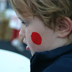 Clown cheeks?