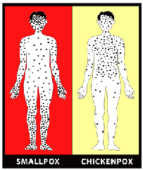 Smallpox_(variola_orthopox_virus_)_Early_Rash_vs_chickenpox