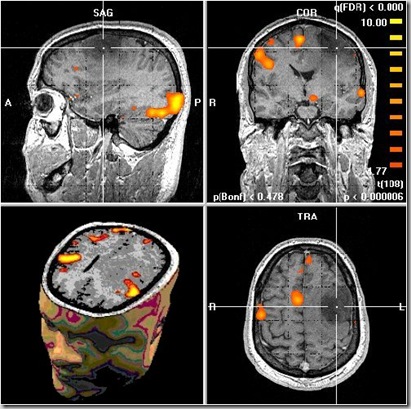 MRI_fMRI