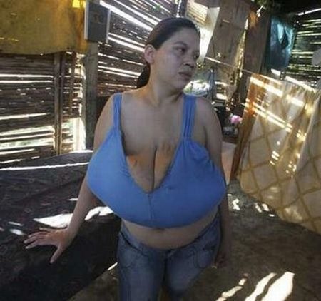 [girl_with_20_pound_breasts_03[3].jpg]