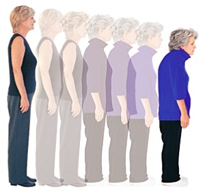 [osteoporose1[3].jpg]