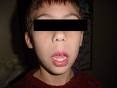 [Facies adenoidea[3].jpg]