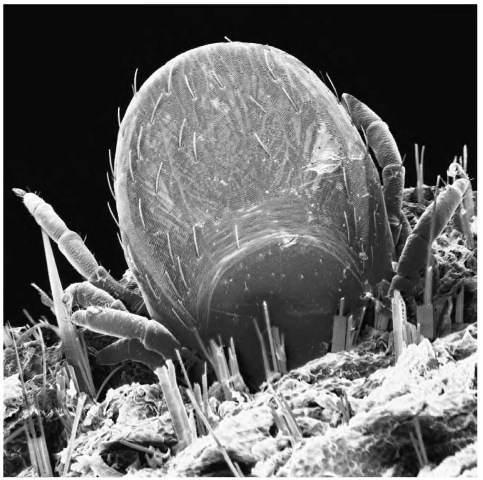 Scanning electron micrograph of a tick feeding in human skin. A tick is a parasitic arthropod that can serve as a vector for bacterial infections, such as Rocky Mountain spotted fever.