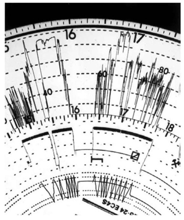 Fraudulent rewinding of tachograph clock. The overlapping traces show that the time was turned back from 1736 hrs to 1623 hrs.