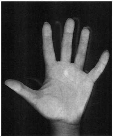 The strange skin on the inside of the hands and fingers.