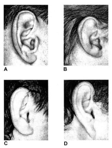 Ear shapes: (A) oval; (B) round; (C) rectangular; (D) triangular.