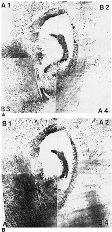 Combining the prints of the known and unknown ears to give (A) A1, B2, B3 and A4; and (B) B1, A2, A3 and B4.