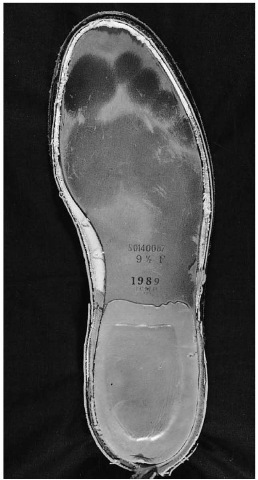 Insole of a shoe, showing the darkened and indented sweat areas caused by the weight-bearing areas of a bare foot.