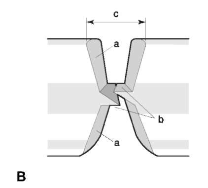 Case study 2. Bolt cutter identification. (A) Left, scene (chain link); right, test cut in lead. A classic striated tool-mark identification in which only a short segment of the cutting jaws were responsible. Identifications of this type can readily be applied to numerous similar implements such as pliers or wire cutters. (B) Cross-section sketch of a cut produced by bolt cutters. Although generally producing striated marks (a), examiners should also be aware that identifiable impressed detail can be left at the very base of the cut (b). When hardened steel (padlock shanks) are cut, poor or no striated features often result, leaving the impressed detail as the only possible means of identification. (c) Profile of cutter blades.