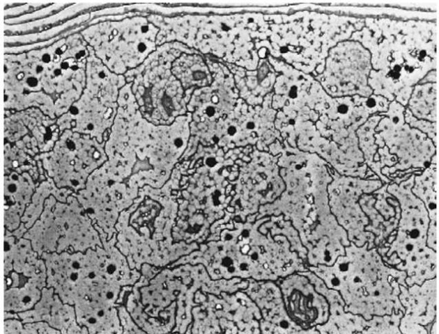 Transmission electron micrograph of human head hair. Each cortical cell contains nuclear remnants and micro fibrils. Melanin granules are scattered throughout the cortex.