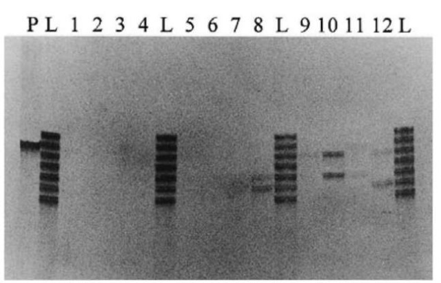 TH01 typing from head hair shaft of the telogen phase on 4% denatured polyacrylamide gel electrophoresis. P: positive control (K562 DNA); L: allelic ladder; 1-12: subjects 112; 8: 6-7; 10: 7-9; 12: 6-9.