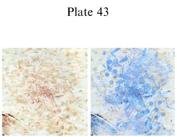 Plate 43 PATTERN EVIDENCE/Footwear Marks Leuco crystal violet is a clear, colorless solution, that can be easily applied at the crime scene or in the laboratory, for the enhancement of bloody footwear impressions. The first picture depicts multiple=