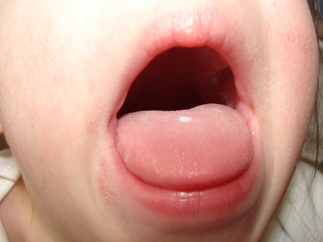 [btonguespot[3].jpg]