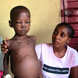  &ndash; Sheku with Kadijah the day before he passed on. His body is full of worms. Feb 2007 (James Mansaray, photographer)
