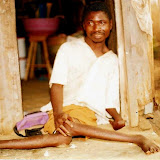  &ndash; Polio Victim (James B. Mansaray, photographer)