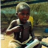  &ndash; Young man with amputated leg (James B. Mansaray, photographer)