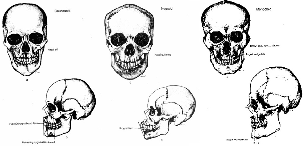 [Skull comparisons[2].jpg]