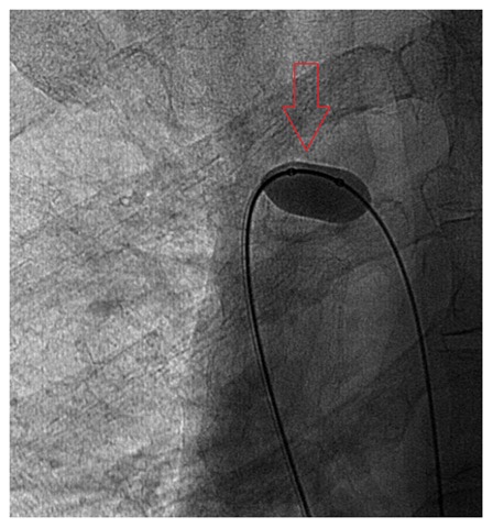 [azygosinflate013.jpg]