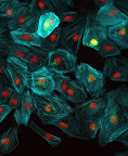 Gabor Foldes, Sian Harding, Michael Schneider y Nadire AliImperial College (Londres)Las células musculares de la fotografía han sido reprogramadas a partir de células madre de laboratorio. De hecho, la posibilidad de reparar tejido cardiaco dañado, por un infarto, por ejemplo, es uno de los campos de investigación más potente en la actualidad. "Nuestro objetivo es llegar a comprender la biología de estas emocionantes células", explica el grupo de autores, "y una vez que sepamos más sobre cómo crecen y se convierten en células cardiacas capaces de latir, esperamos ser capaces de utilizarlas en la reparación de corazones dañados". Gabor Foldes, Sian Harding, Michael Schneider y Nadire AliImperial College (Londres)Las células musculares de la fotografía han sido reprogramadas a partir de células madre de laboratorio. De hecho, la posibilidad de reparar tejido cardiaco dañado, por un infarto, por ejemplo, es uno de los campos de investigación más potente en la actualidad. "Nuestro objetivo es llegar a comprender la biología de estas emocionantes células", explica el grupo de autores, "y una vez que sepamos más sobre cómo crecen y se convierten en células cardiacas capaces de latir, esperamos ser capaces de utilizarlas en la reparación de corazones dañados".
