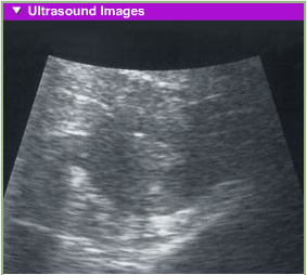 [fetal development 1st month usg[9].png]