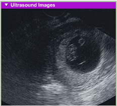 fetal development 2nd month usg