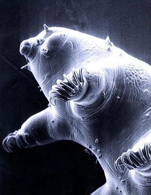 [tardigrade-water-bear[6].jpg]
