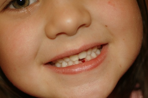 [KyliesLostTooth-8[2].jpg]