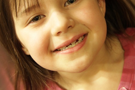 [KyliesLostTooth[2].jpg]