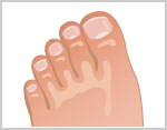 Image Dimension: 150x117 :: Did you know that according to the Chinese, your feet describe your luck. Decipher your Fortune! Did you know that according to the Chinese, your feet describe your luck. Decipher your Fortune!