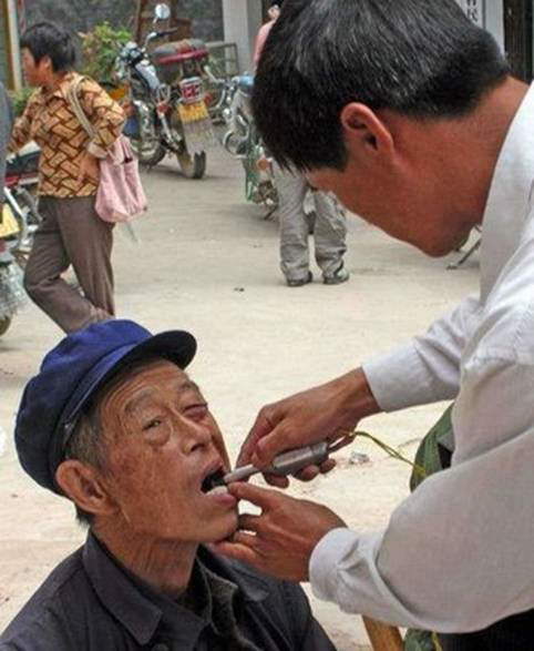 Street Dentists In India And China: Do you dare visit them? LOL