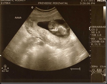 Ultrasound2