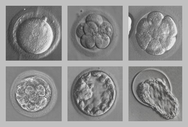 [Early_human_embryos[3].png]