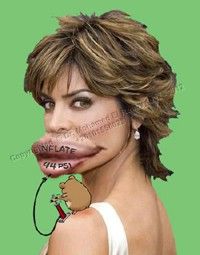 overinflation lips overinflation lips