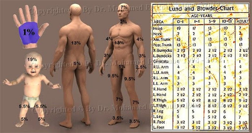 Lund and Browder Chart Lund and Browder Chart