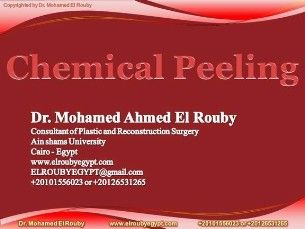 chemical peeling presntation
