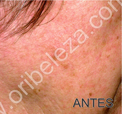 Gama Despigmentante Optimals Even Out da Oriflame