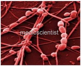 [infections caused by Streptococci2[2].jpg]