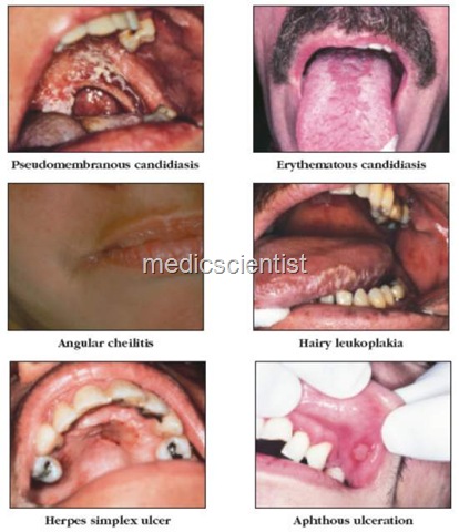 [Clinical features and Course of HIV infection da[5].jpg]