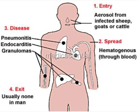 [Q - FEVER ss[2].jpg]
