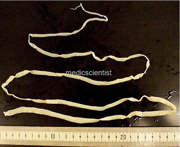 [CESTODES (Tape Worms) juh[2].jpg]