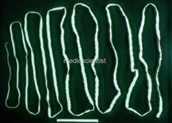 [TAENIA SAGINATA gfv[2].jpg]