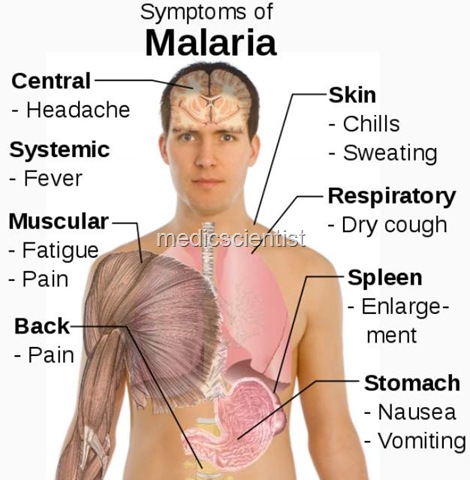 [Clinical Features Symptoms malaris[2].jpg]