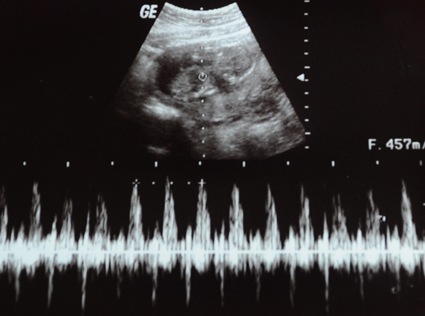 20110202_Ultrasound