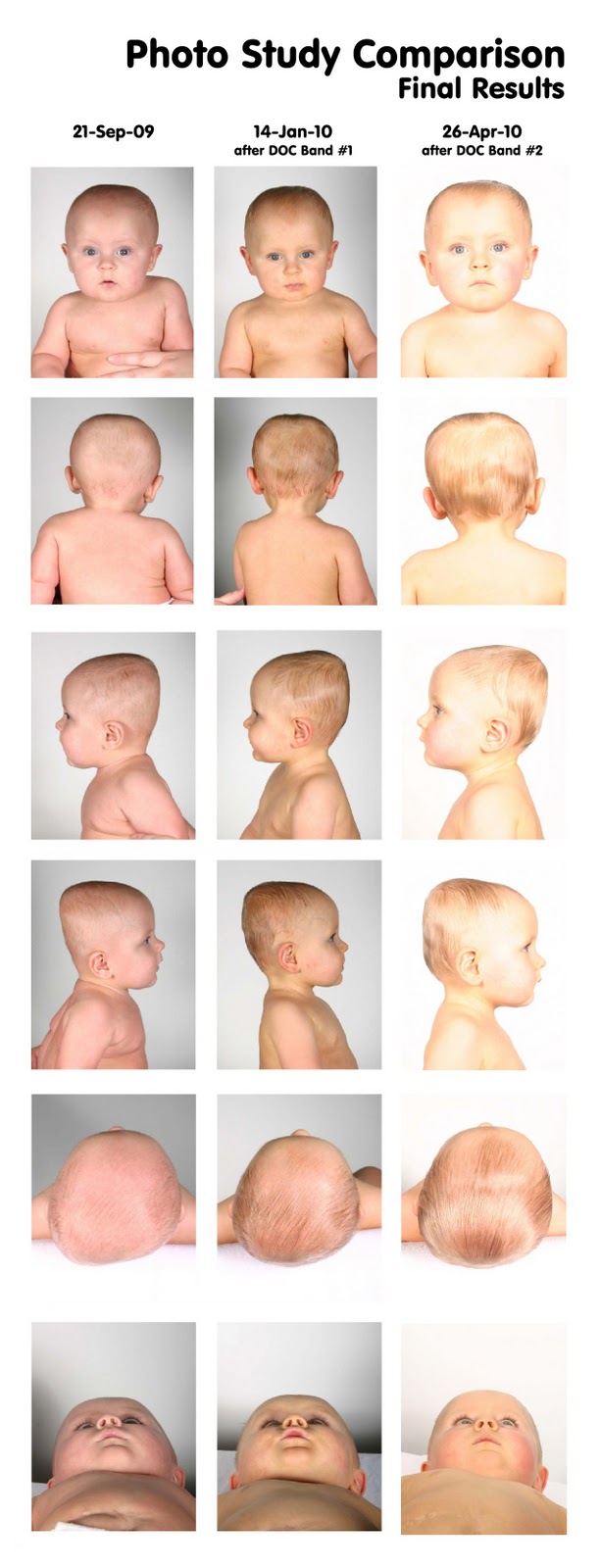 [Photo Study Comparison - Final Results - 09.21.09 to 01.14.10 to 04.26.10[13].jpg]