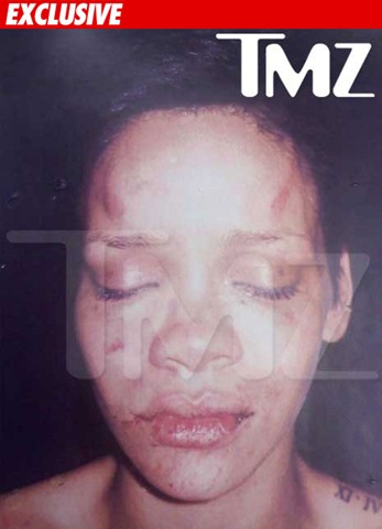 [Popstar rihanna photo after beaten by Chris Brown TMZ[4].jpg]