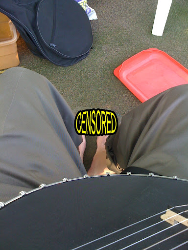 Deformed Toenail