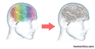 brain_g.jpg