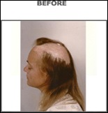 woman2-before