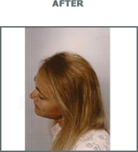 [woman2-after[9].jpg]